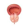 Prostata